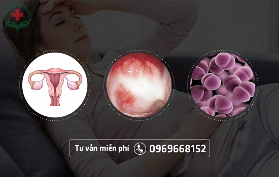 Hình ảnh bệnh lậu ở nữ giới Hình ảnh bệnh lậu ở nữ giới