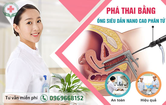 phá thai bằng ống dẫn nano phá thai bằng ống dẫn nano